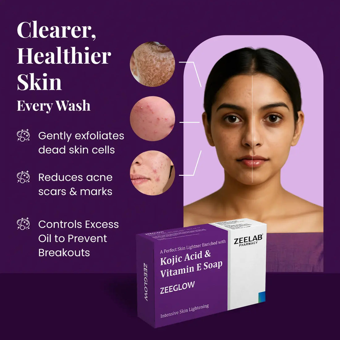 ZEEGLOW Kojic Acid and Vitamin E Soap 75gm
